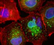 Die Brustkrebs-Zelllinie MCF7 produziert das Mikroprotein CASIMO1 (grün). Rot dargestellt ist das Zellskelett-Protein Aktin, blau die Zellkerne. (Bild: M. Polycarpou-Schwarz; S. Diederichs, DKFZ) Mikroskopische Aufnahme: Brustkrebs-Zelllinie MCF7 produziert Mikroprotein CASIMO1