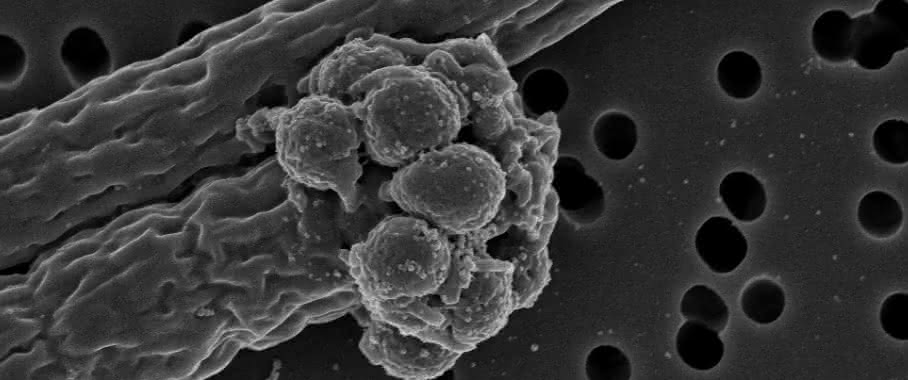 Die Rasterelektronenmikroskop-Aufnahme zeigt zwei cyanobakterielle Filamente ... Rasterelektronenmikroskop-Aufnahme von Cyanobakterienfilamenten