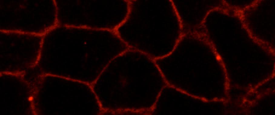 Mikroskopische Aufnahme des fluoreszenzmarkierten neuen Membranstoffs.