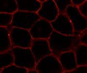 Eine neue Verbindung verhält sich in Membranen von lebenden Zellen (hier: HeLa-Zellen) ähnlich dem natürlichen Cholesterol. Der Stoff ist mit einem Fluoreszenzfarbstoff (rot) markiert. (Bild: L. Rakers et al./Cell Chem Biol) Mikroskopische Aufnahme des fluoreszenzmarkierten neuen Membranstoffs.