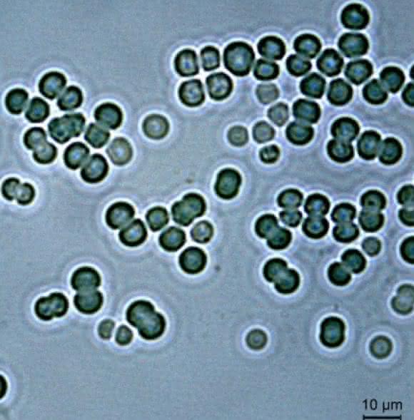 Lichtmikroskopische Aufnahme von Zellen des Cyanobakteriums Synechocystis sp. PCC6803. (Bild: Khaled Selim) Lichtmikroskopische Aufnahme von Zellen des Cyanobakteriums Synechocystis