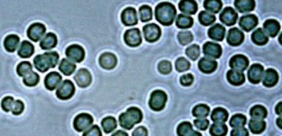 Lichtmikroskopische Aufnahme von Zellen des Cyanobakteriums Synechocystis