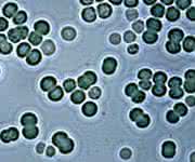 Lichtmikroskopische Aufnahme von Zellen des Cyanobakteriums Synechocystis
