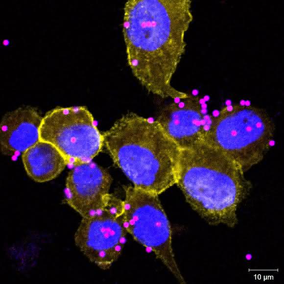 Fluoreszenzmikroskopische Aufnahme von menschlichen Makrophagen (THP-1 Zelllinie), inkubiert mit blau und rot gefärbten Partikeln. Der rote Farbstoff ist nur in saurem Milieu aktiv, gelb = SLC4A7. (Bild: CeMM)