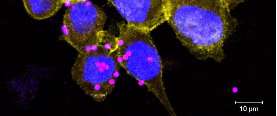 Fluoreszenzmikroskopische Aufnahme von menschlichen Makrophagen (THP-1 Zelllinie), inkubiert mit blau und rot gefärbten Partikeln. Der rote Farbstoff ist nur in saurem Milieu aktiv, gelb = SLC4A7. (Bild: CeMM)