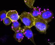 Fluoreszenzmikroskopische Aufnahme von menschlichen Makrophagen (THP-1 Zelllinie), inkubiert mit blau und rot gefärbten Partikeln. Der rote Farbstoff ist nur in saurem Milieu aktiv, gelb = SLC4A7. (Bild: CeMM)