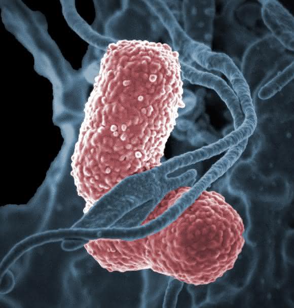 Klebsiella pneumoniae, ein häufiger Erreger von Krankenhausinfekten, unter dem Elektronenmikroskop. (Bild: Niaid, Wikimedia)