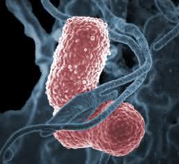 Klebsiella pneumoniae, ein häufiger Erreger von Krankenhausinfekten, unter dem Elektronenmikroskop. (Bild: Niaid, Wikimedia) Klebsiella pneumoniae, ein häufiger Erreger von Krankenhausinfekten, unter dem Elektronenmikroskop. (Bild: Niaid, Wikimedia)