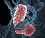 Klebsiella pneumoniae, ein häufiger Erreger von Krankenhausinfekten, unter dem Elektronenmikroskop. (Bild: Niaid, Wikimedia) Klebsiella pneumoniae, ein häufiger Erreger von Krankenhausinfekten, unter dem Elektronenmikroskop. (Bild: Niaid, Wikimedia)
