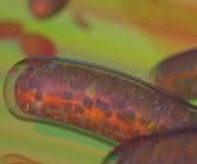Mitochondrien (rot) sind die Kraftwerke der Zelle. Mutationen in ihrer DNA können schwere Erkrankungen wie ... Mitochondrien