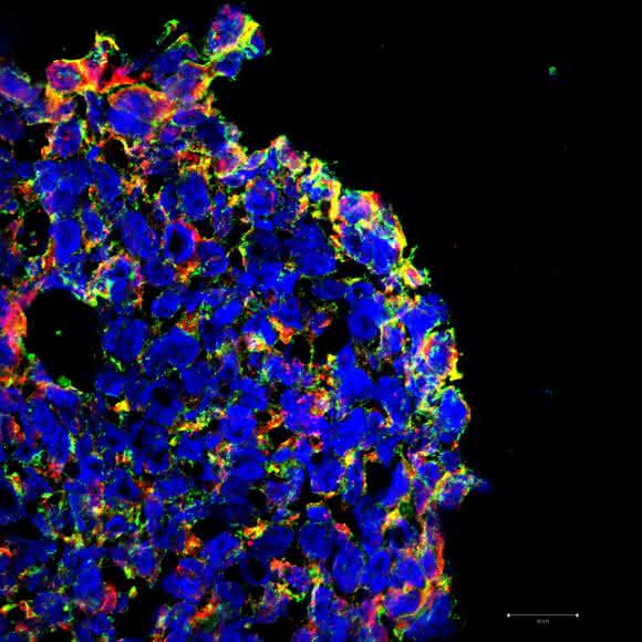 In einem dreidimensionalen Darmkrebs-Zellkulturmodell werden durch den Wirkstoff KP-1339 (IT-139) Merkmale ausgelöst, die im Organismus den immunogenen Zelltod hervorrufen (Bild: Universität Wien).