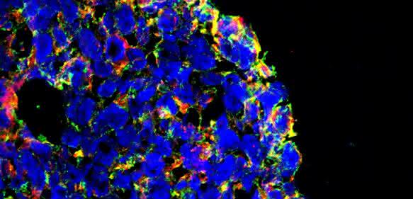 In einem dreidimensionalen Darmkrebs-Zellkulturmodell werden durch den Wirkstoff KP-1339 (IT-139) Merkmale ausgelöst, die im Organismus den immunogenen Zelltod hervorrufen (Bild: Universität Wien).