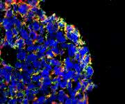 In einem dreidimensionalen Darmkrebs-Zellkulturmodell werden durch den Wirkstoff KP-1339 (IT-139) Merkmale ausgelöst, die im Organismus den immunogenen Zelltod hervorrufen (Bild: Universität Wien).