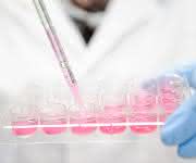 Laborbild: Pipettieren in eine Multiwellplatte