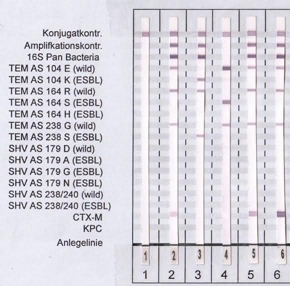 Mutationen in den Laktamase-Genen für TEM und SHV