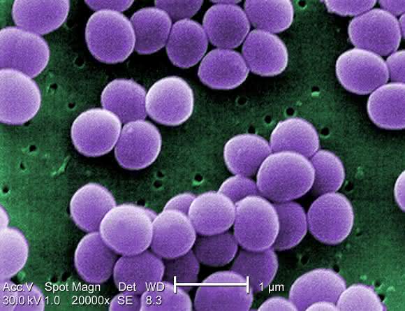 Mikroskopaufnahme von Staphylococcus aureus