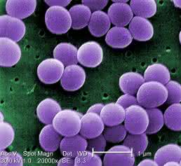 Mikroskopaufnahme von Staphylococcus aureus