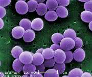 Mikroskopaufnahme von Staphylococcus aureus
