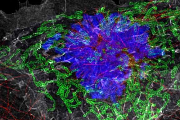 Das Lightning-Detektionspaket extrahiert umfassende Informationen aus einem Bild ... Mikroskopische Aufnahme einer Zelle mit Mitochondrien, Tubulin und Aktin