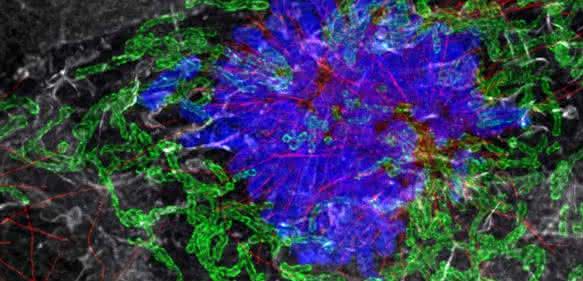 Mikroskopische Aufnahme einer Zelle mit Mitochondrien, Tubulin und Aktin