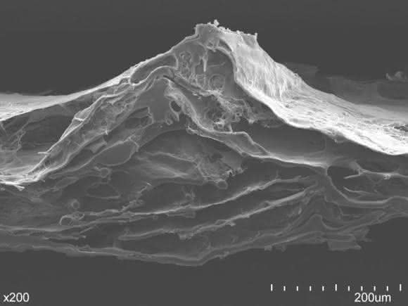 Elektrospinning: Kollagen-Vlies für die regenerative Medizin Elektrospinning: Kollagen-Vlies für die regenerative Medizin