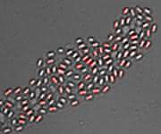 Mikrobiologie: Bakterielle Sporen mit „Gedächtnis“