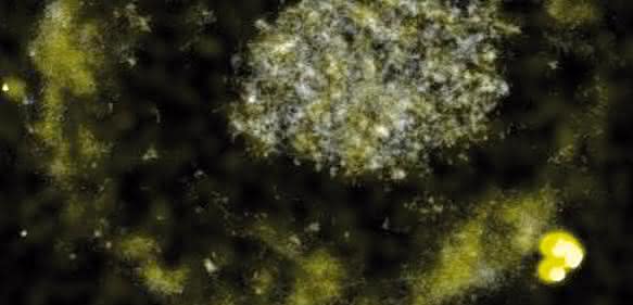 Das Bakterium C. metallidurans bildet winzig kleine Gold-Nuggets. (Bild: American Society for Microbiology) Das Bakterium C. metallidurans bildet winzig kleine Gold-Nuggets. (Bild: American Society for Microbiology)