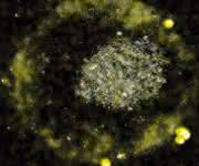 Das Bakterium C. metallidurans bildet winzig kleine Gold-Nuggets. (Bild: American Society for Microbiology) Das Bakterium C. metallidurans bildet winzig kleine Gold-Nuggets. (Bild: American Society for Microbiology)