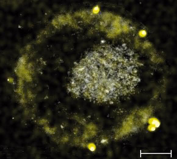 Das Bakterium C. metallidurans bildet winzig kleine Gold-Nuggets. (Bild: American Society for Microbiology) Das Bakterium C. metallidurans bildet winzig kleine Gold-Nuggets. (Bild: American Society for Microbiology)