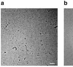 Ernst Ruska Prize 2017: Cryo-EM structure of haemoglobin at 3.2 Å determined with the Volta phase plate