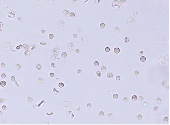 Erythrozyten