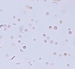 Erythrozyten