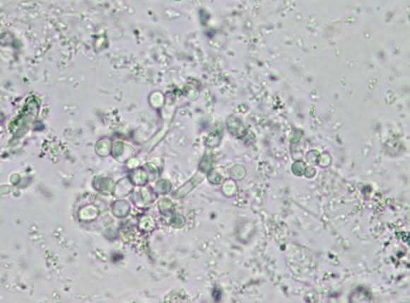 Pilzmycel mit Hefezellen
