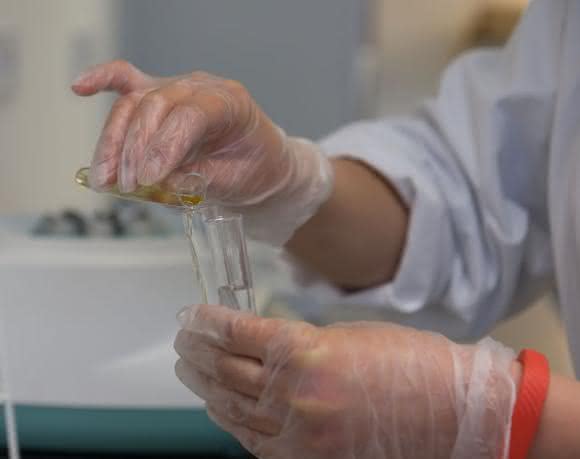 Lichtmikroskopische Urinanalyse: Screening auf Stoffwechselstörung