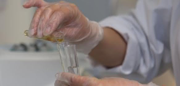 Lichtmikroskopische Urinanalyse: Screening auf Stoffwechselstörung