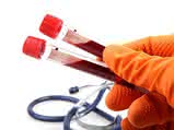 In-Vitro-Diagnostika-Verordnung IVDR 2017/746 In-Vitro-Diagnostika-Verordnung IVDR 2017/746