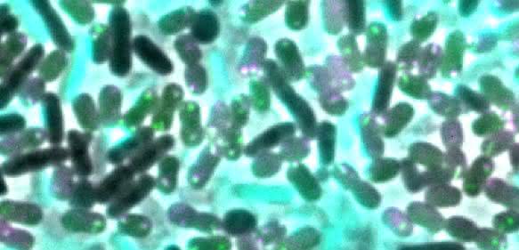 Multiresistente Keime: Resistenzen bei der Konkurrenz besorgt