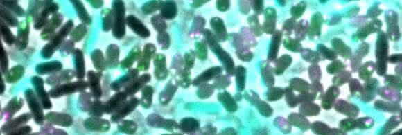 Multiresistente Keime: Resistenzen bei der Konkurrenz besorgt