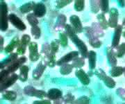 Multiresistente Keime: Resistenzen bei der Konkurrenz besorgt