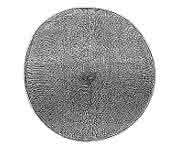 Röntgenhologramm (Ausschnitt) einer Schale der Kieselalge Actinoptychus senarius mit einem Durchmesser von nur 0,1 Millimetern.