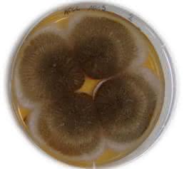 Aspergillus-niger-Pilz Aspergillus-niger-Pilz