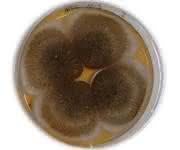 Aspergillus-niger-Pilz