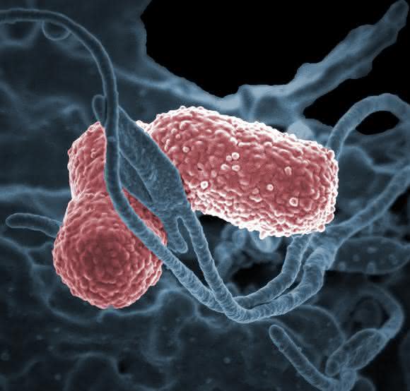 Klebsiella pneumoniae Multiresistente Bakterien: Wie natürliche Killerzellen Klebsiella besiegen