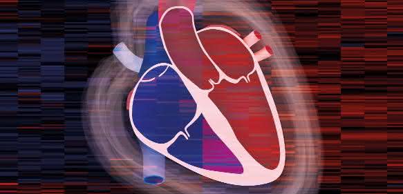Herzschemata mit Heatmap