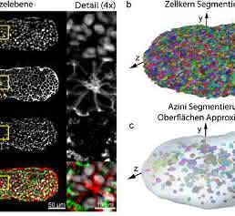 Lichtscheiben-Fluoreszenzmikroskopie: Biologische Proben in 3D