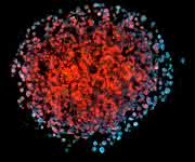 3D-Spheroid von Brustkrebszellen in Kultur. Die invasiven (metastasierenden) Zellen erscheinen durch überlappende Fluoreszensmarkierung des Leptin-Receptors und eines Metastasierungsmarkers hellblau. Zellkerne sind rot gefärbt. (Bild: Helmholtz Zentrum München) 3D-Spheroid von Brustkrebszellen in Kultur