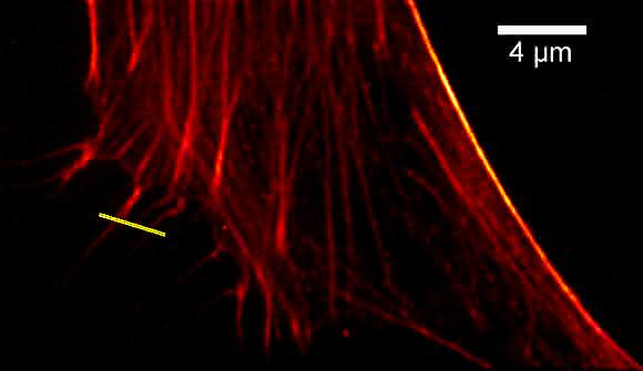 Hochaufgelöste Aufnahme des Actin-Zytoskelets in menschlichen Stammzellen.