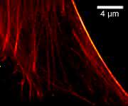 Hochaufgelöste Aufnahme des Actin-Zytoskelets in menschlichen Stammzellen. (Bild: Uni Göttingen) Hochaufgelöste Aufnahme des Actin-Zytoskelets in menschlichen Stammzellen.