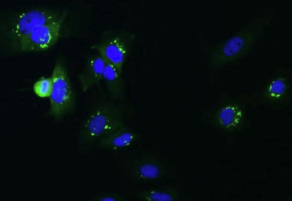 Fluoreszenzmikroskopische Aufnahme humaner Hepatomzellen (HuH7), die mit dem Marburg-Virus infiziert wurden