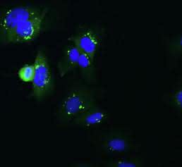 Fluoreszenzmikroskopische Aufnahme humaner Hepatomzellen (HuH7), die mit dem Marburg-Virus infiziert wurden
